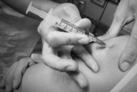 Прививка акдс: расшифровка, виды вакцин и состав, график прививок, ревакцинация и побочные эффекты