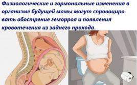 Лечение геморроя в домашних условиях при беременности
